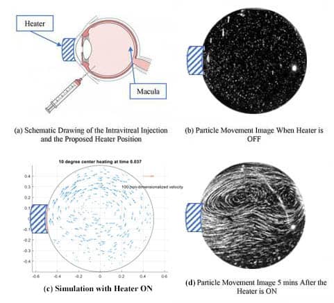 Simulation of Heating to Promote Drug Mixing in the Eye